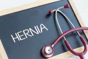 hernia workers comp