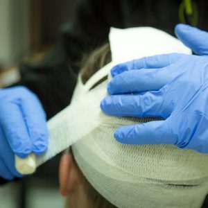 closed-and-open-head-injuries-at-work-everything-you-need-to-know